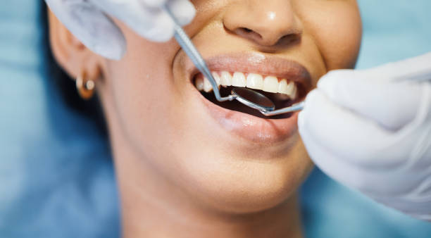Best Emergency Dentist for Knocked-Out Tooth in Hewitt, NJ